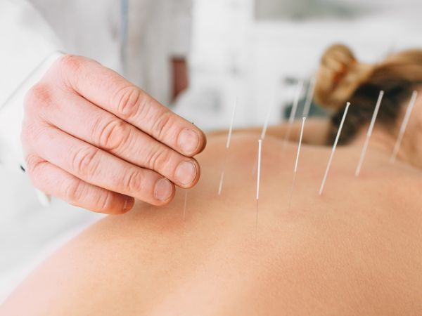 Sistema para Acupuntura - CRM